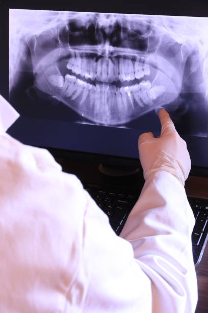 Best Knocked-Out Tooth (Avulsed Tooth) Treatment in Vinton, VA