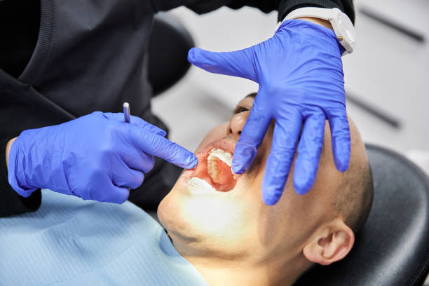 Best Dental Abscess Treatment in Vinton, VA